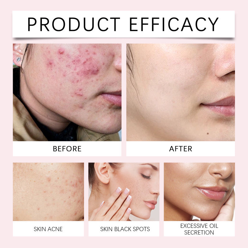 Kojic Acid & Turmeric Brightening Cleansing Pads with Vitamin C - 40 Count